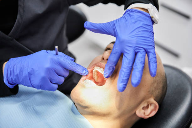 Best Broken or Chipped Tooth Repair in , OK